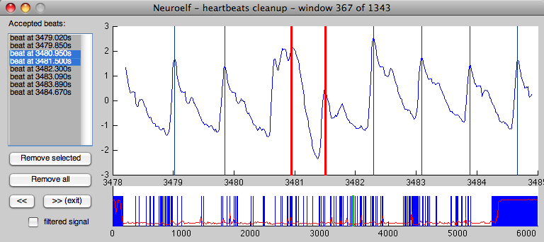 Noisy ECG example