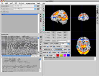 Canonical three-slice view